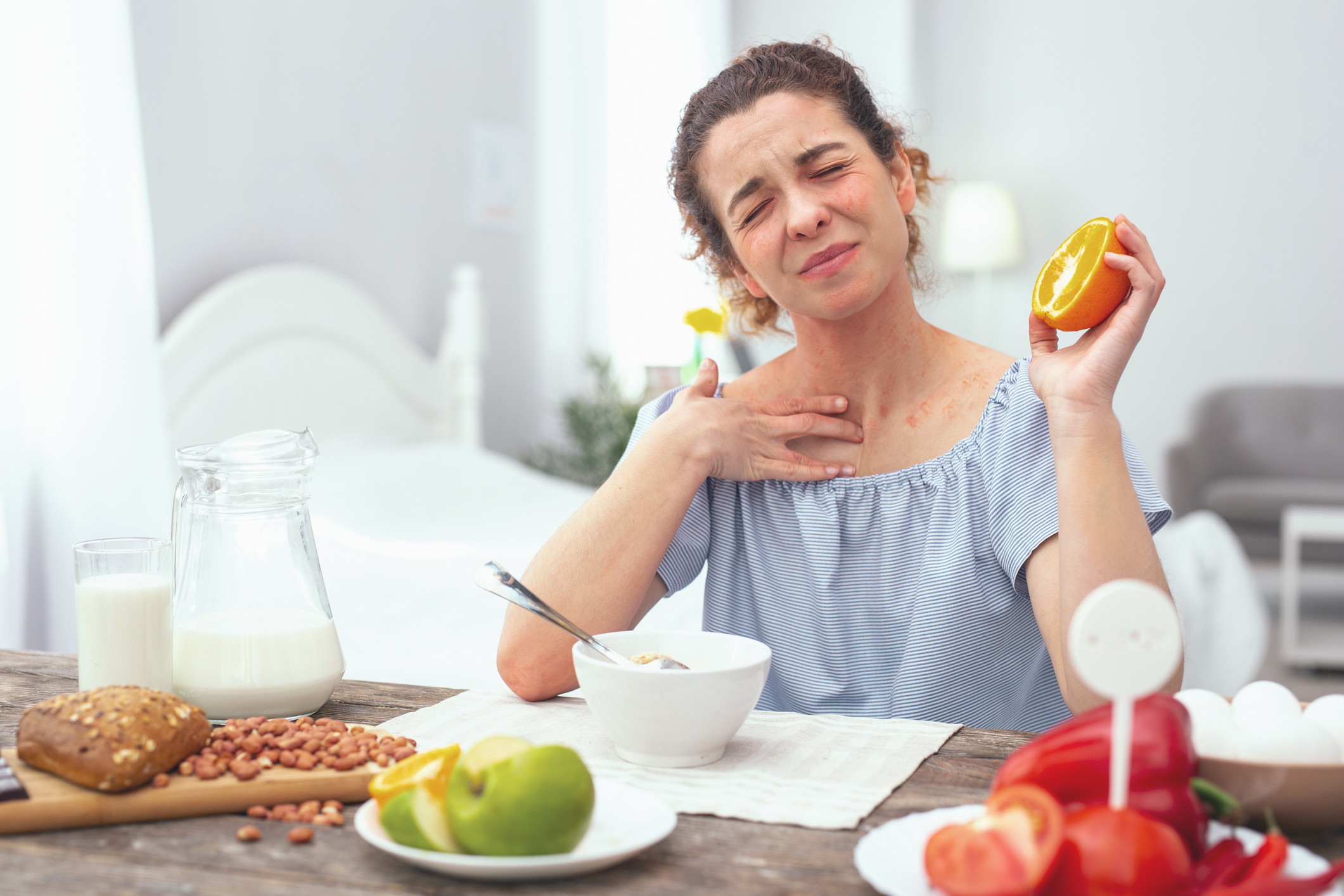 Vid atopisk dermatit är citrusfrukter förbjudna