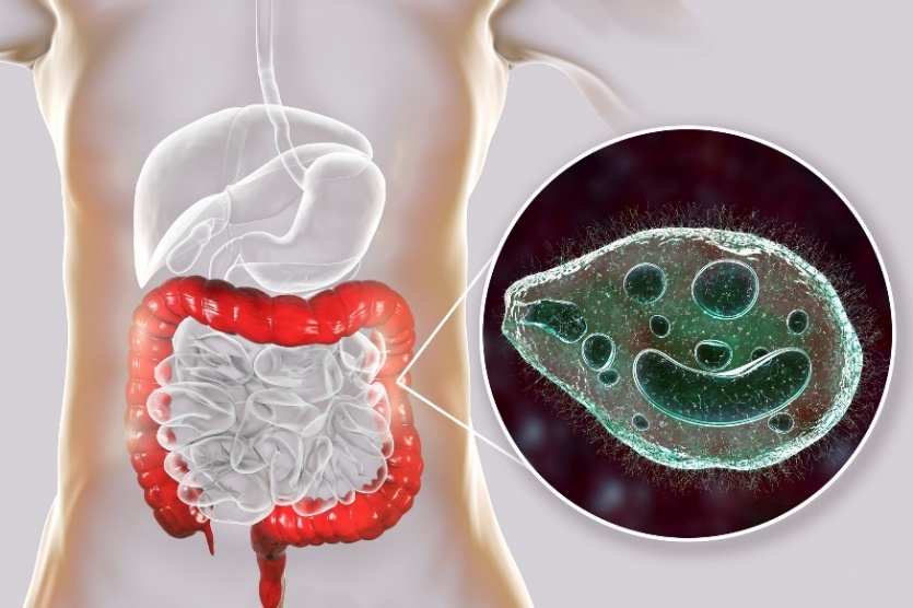 Balantidium coli - en parasit som infekterar tjocktarmen i människans matsmältningskanal