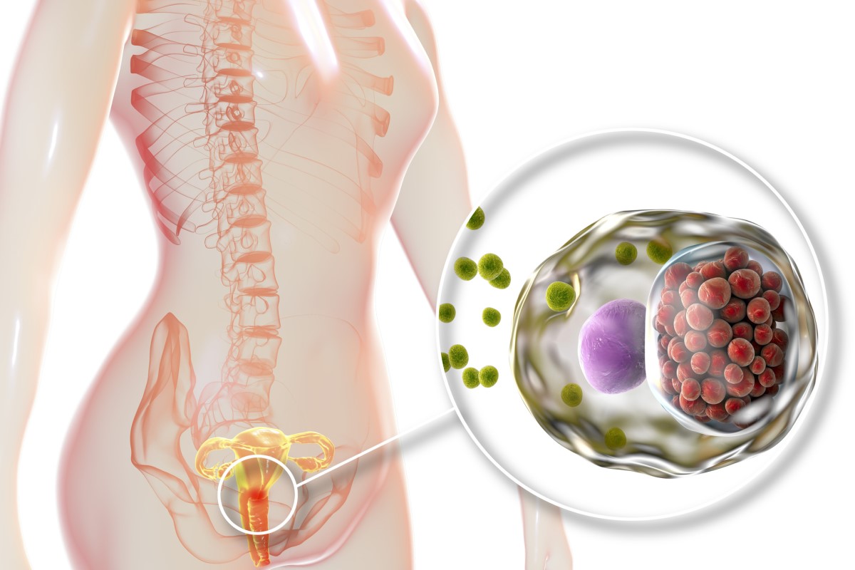 Infektionen har trängt in i livmoderhalsen - anatomisk bild av det kvinnliga fortplantningssystemet