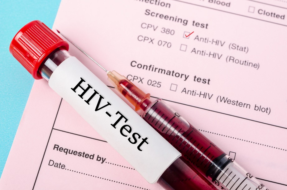 Diagnostiskt test för förekomst av anti-HIV-antikroppar i ett blodprov från en patient