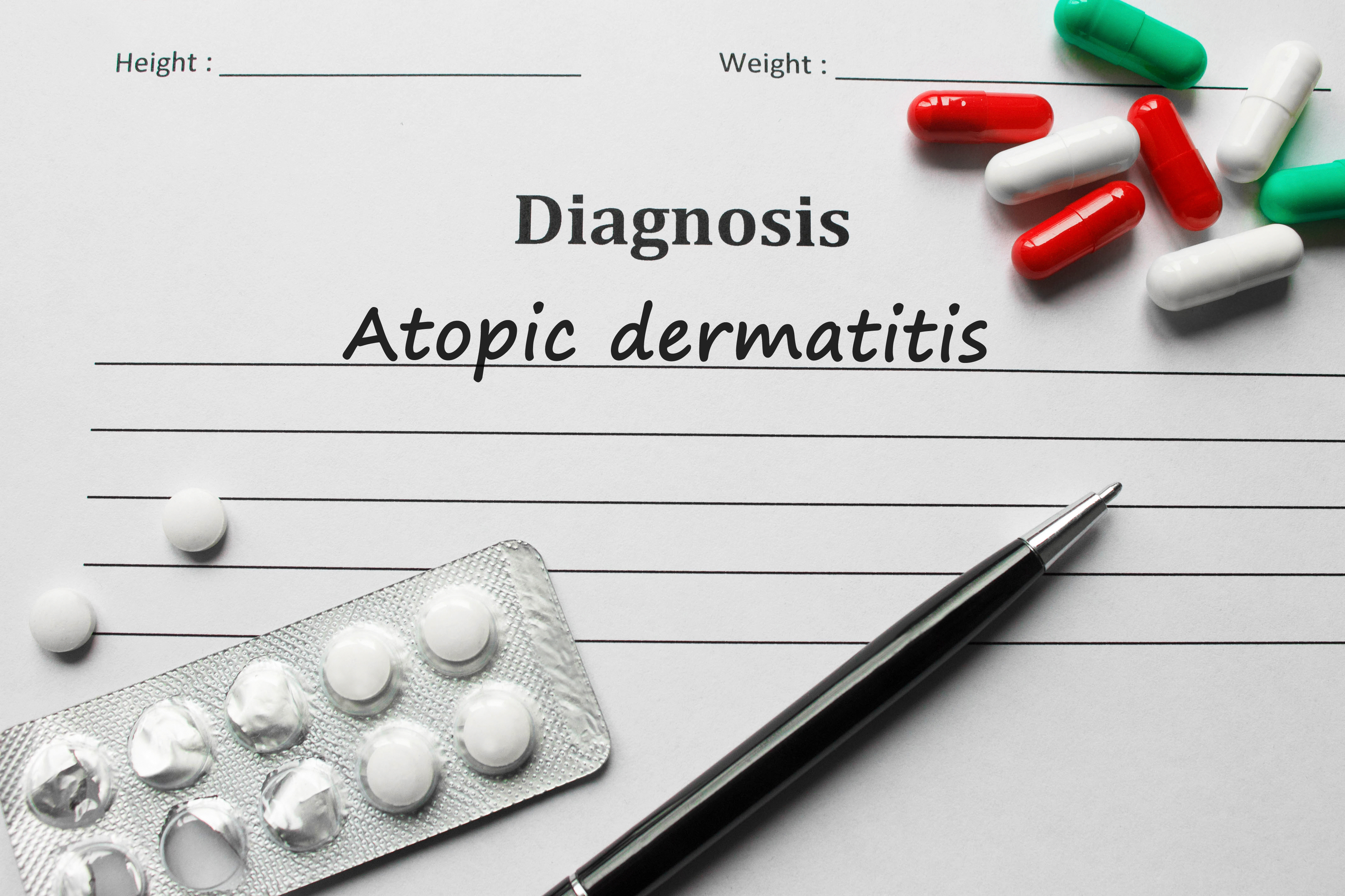 Diagnos av atopisk dermatit