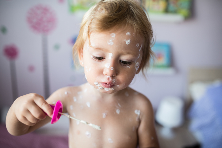 En liten flicka har ett lindrigt fall av vattkoppor - hon leker med en bubbelblåsare