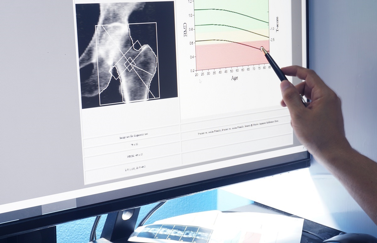 Bild av densitometer och grafisk representation av värden