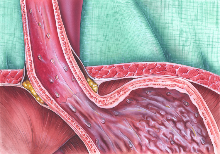 anatomiskt avbildad sfinkter på matstrupen