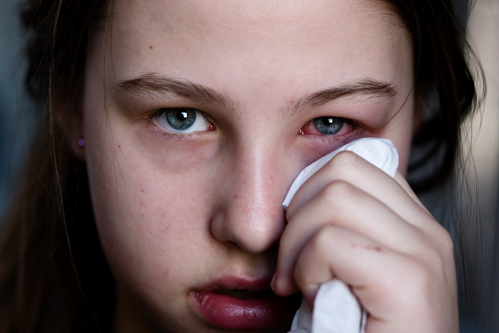 flicka har ögoninflammation, ögonsvullnad, ögonrodnad, hand, näsduk