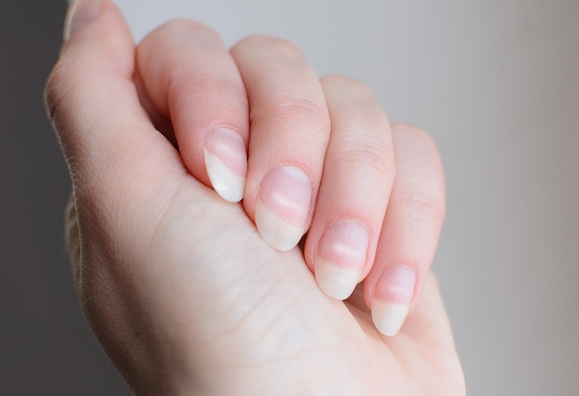 Leukonyki och bildning av vita fläckar på nagelplattan