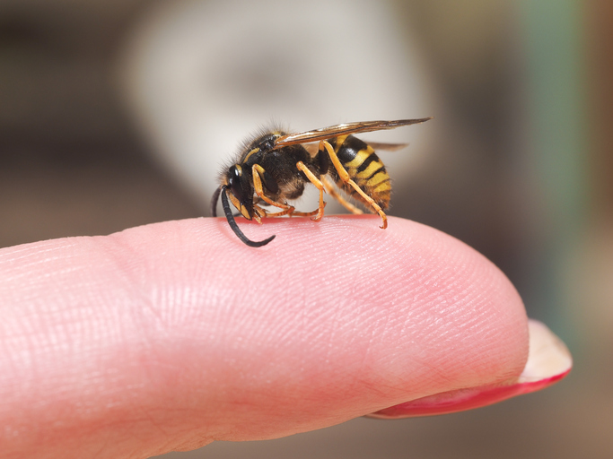 En geting som sitter på ett finger, ett tecken på allergi mot insektsbett