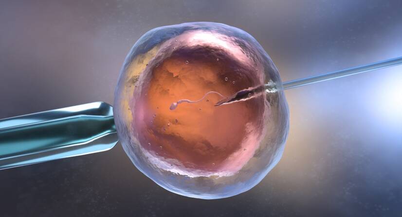 In vitro-fertilisering IVF. Källa: Getty Images