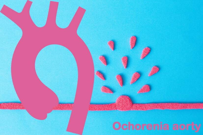 Aortasjukdom: aneurysm, dissektion och andra? Känn till orsakerna, symptomen