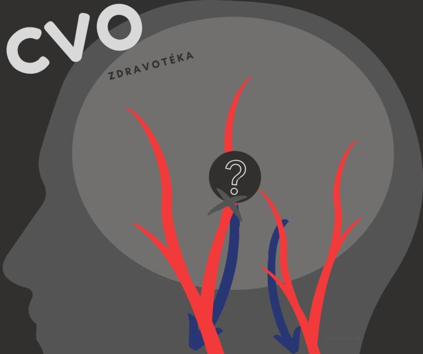 Cerebrovaskulär sjukdom: försvagade, förträngda eller utvidgade blodkärl i hjärnan? Känn till orsaker och symtom