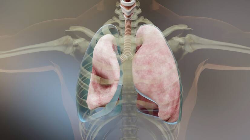 Pneumothorax (luft i bröstet): orsaker, symtom och första hjälpen