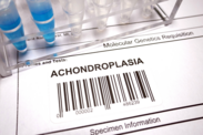 Achondroplasia: Vilka är orsakerna till och symptomen på medfödd benskörhet?